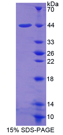 Recombinant Occludin/ELL Domain Containing Protein 1 (OCEL1)