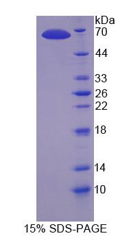 Recombinant Dynein Heavy Chain Domain Containing Protein 1 (DNHD1)