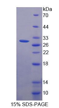 Recombinant WD Repeat Containing Domain Protein 90 (WDR90)