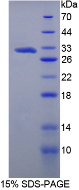 Recombinant Methyltransferase Like Protein 21C (METTL21C)