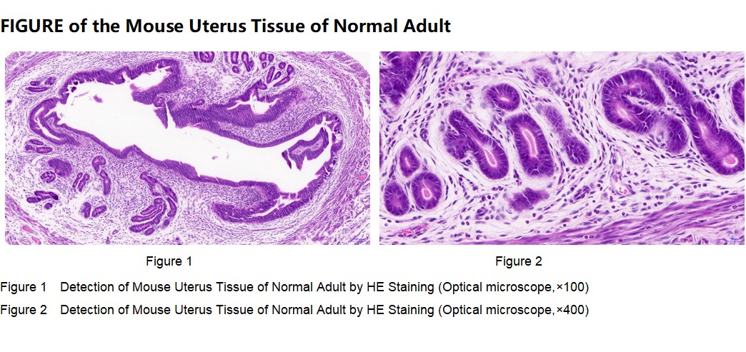 Mouse Uterus Tissue of Normal Adult