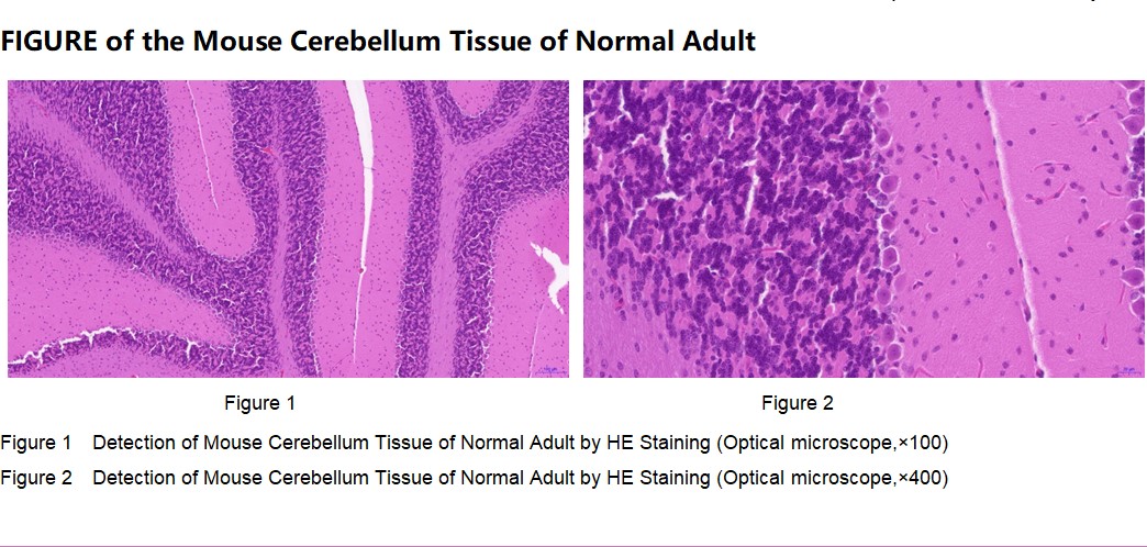 Mouse Cerebellum Tissue of Normal Adult