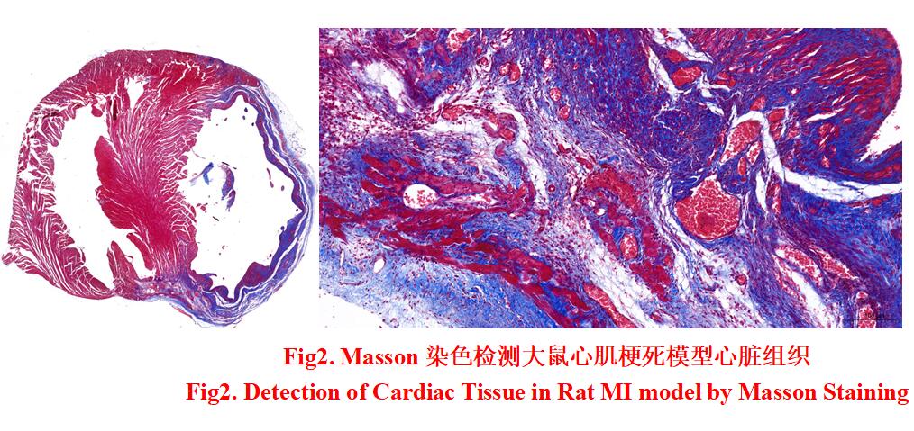 Rat Heart Tissue of Myocardial Infarction (MI)
