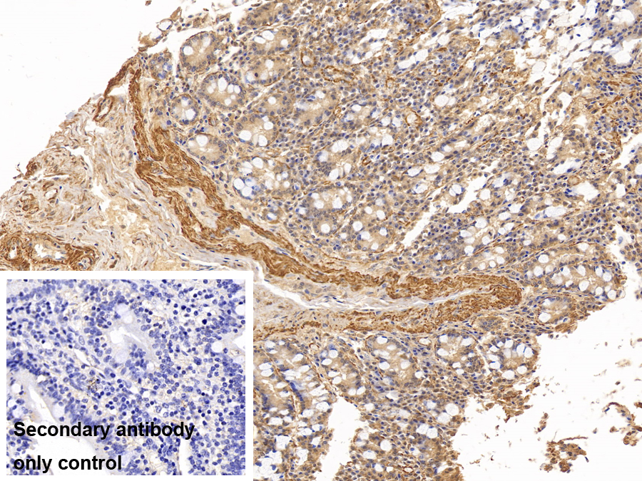 Anti-Actin Alpha 1, Cardiac Muscle (ACTC1) Monoclonal Antibody