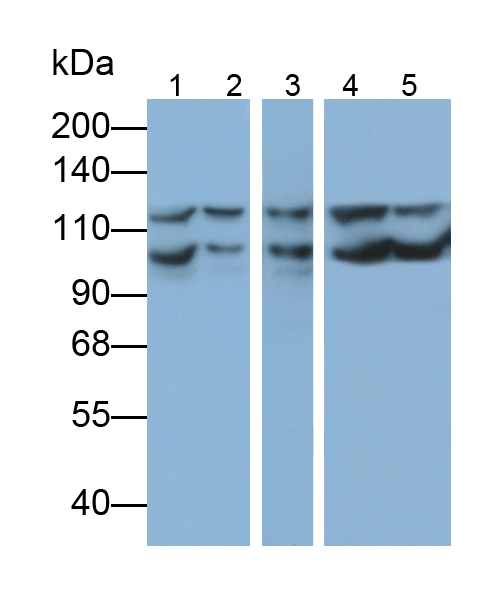 Anti-Vinculin (VCL) Polyclonal Antibody