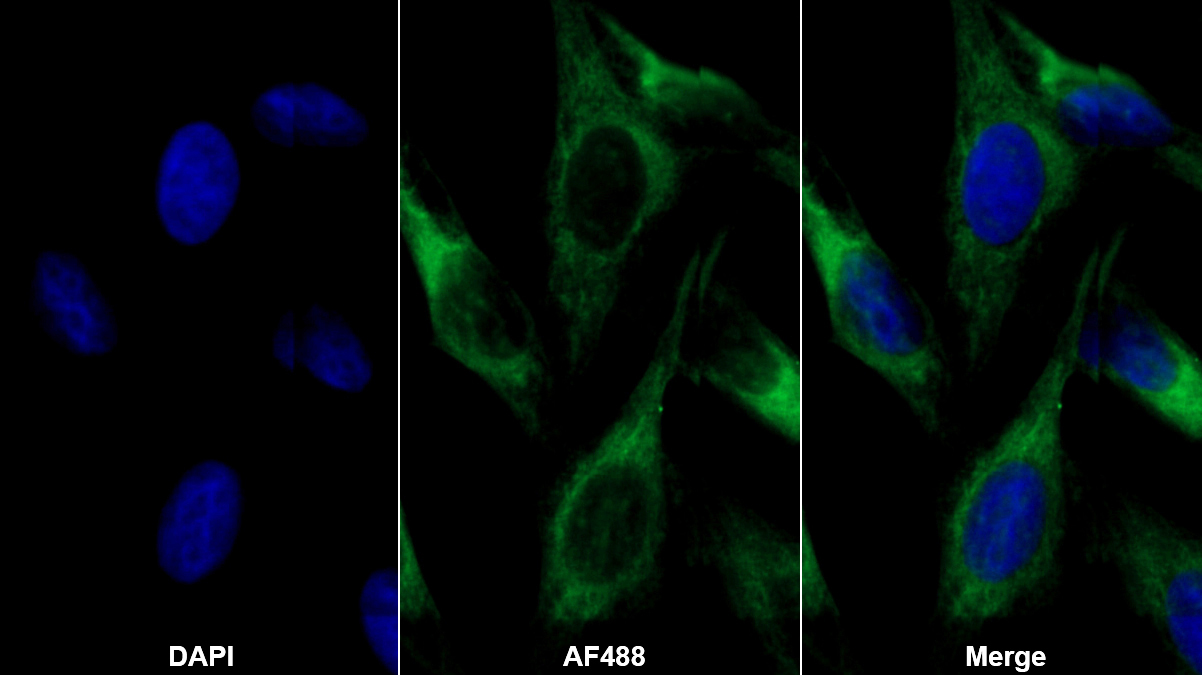 Anti-Voltage Dependent Anion Channel Protein 1 (VDAC1) Monoclonal Antibody