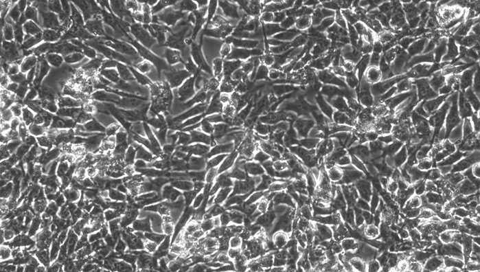 Primary Porcine Adrenal Cortical Cells (ADCC)