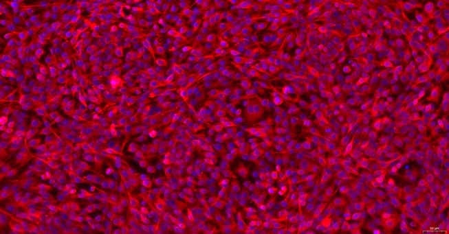 Primary Feline Annulus Fibrosus Cells (AFC)