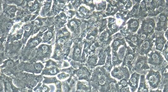 Primary Porcine Annulus Fibrosus Cells (AFC)