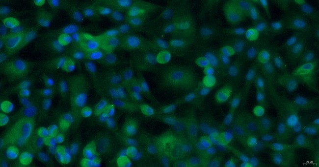 Primary Canine Retinal Astrocytes (RA)