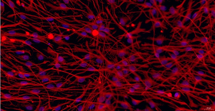 Primary Feline Brain Astrocytes (BA)