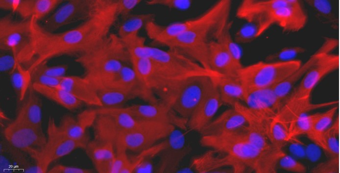 Primary Rat Brain Astrocytes (BA)