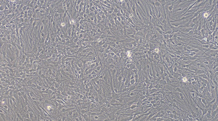 Primary Rat Brain Astrocytes (BA)