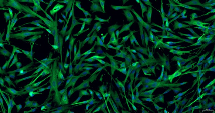 Primary Rabbit Brain Astrocytes (BA)