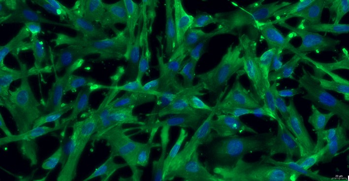 Primary Rabbit Brain Astrocytes (BA)