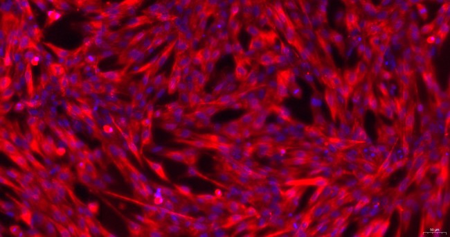 Primary Canine Brain Microvascular Endothelial Cells (BMEC)