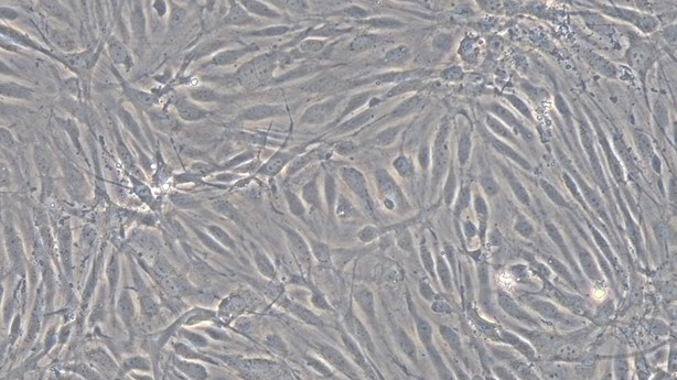 Primary Mouse Brain Microvascular Endothelial Cells (BMEC)