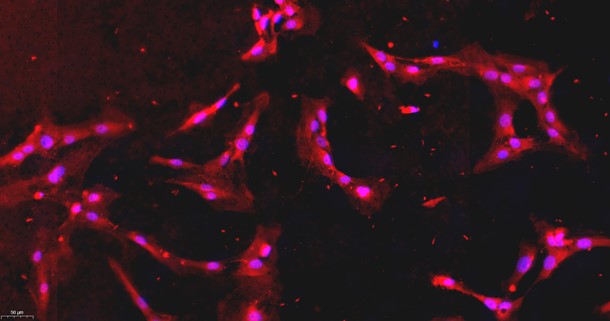 Primary Mouse Brain Microvascular Endothelial Cells (BMEC)