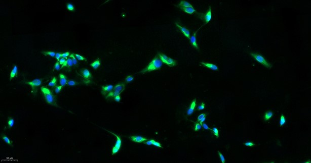 Primary Mouse Brain Microvascular Endothelial Cells (BMEC)