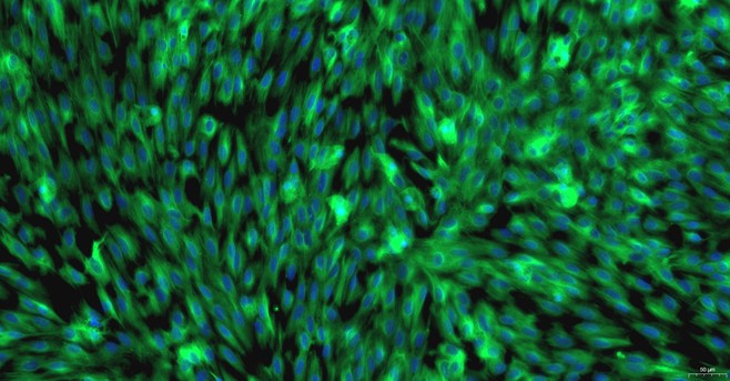 Primary Rat Brain Microvascular Endothelial Cells (BMEC)