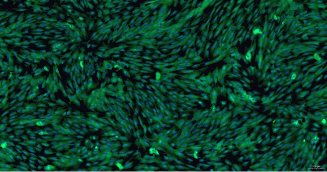 Primary Rat Brain Microvascular Endothelial Cells (BMEC)
