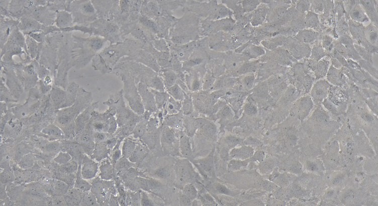 Primary Mouse Choroid Plexus Epithelial Cells (CPEC)