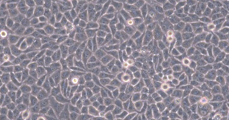 Primary Human Umbilical Vein Endothelial Cells (UVEC)