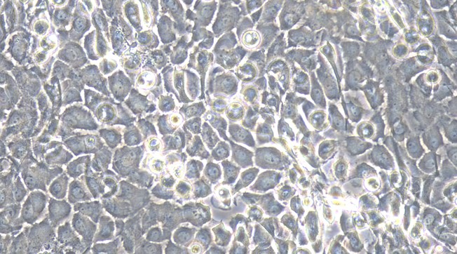 Primary Mouse Corneal Epithelial Cells (CEC)