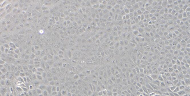 Primary Rabbit Corneal Epithelial Cells (CEC)