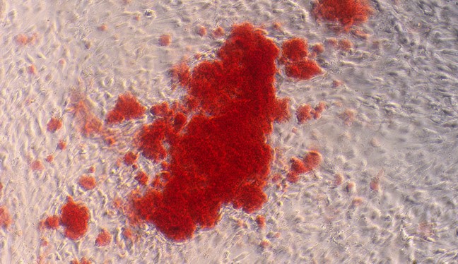Primary Rabbit Adipose-derived Mesenchymal Stem Cells (ADSCs)