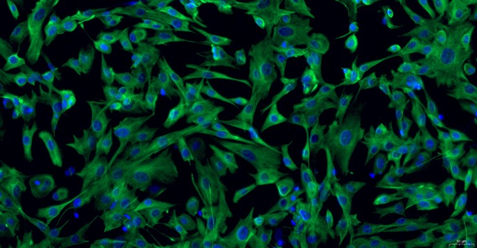 Primary Caprine Pulmonary Fibroblasts (PF)