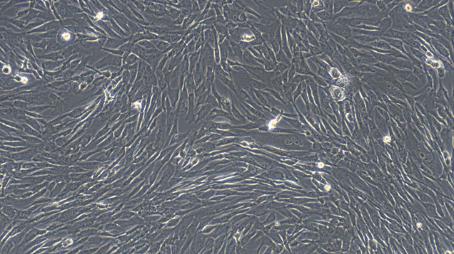 Primary Cavia Pulmonary Fibroblasts (PF)