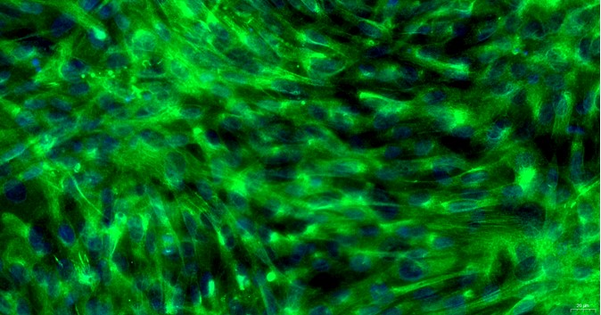 Primary Feline Thymic Fibroblasts (TF)