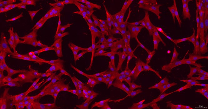 Primary Canine Uterine Smooth Muscle Cells (USMC)