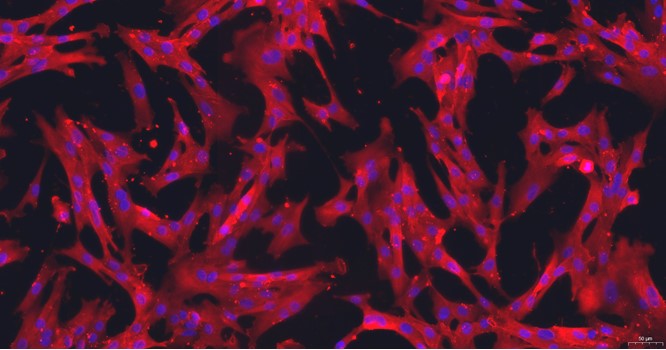 Primary Canine Uterine Smooth Muscle Cells (USMC)