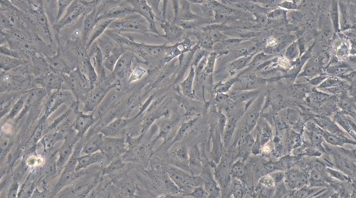 Primary Mouse Uterine Smooth Muscle Cells (USMC)