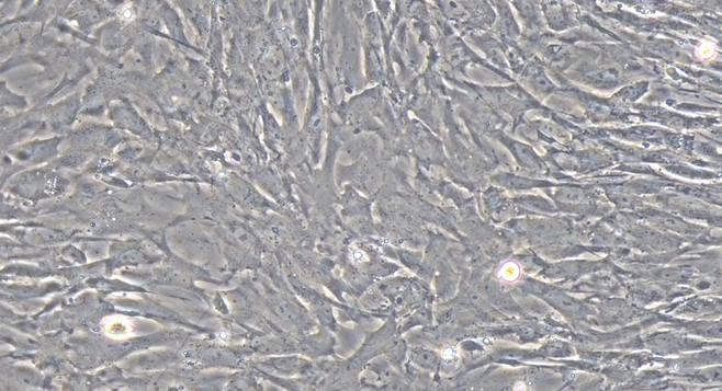 Primary Rat Uterine Smooth Muscle Cells (USMC)