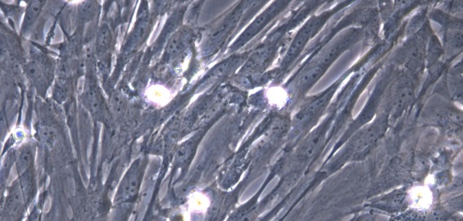 Primary Canine Choroid Plexus Fibroblasts (CPF)