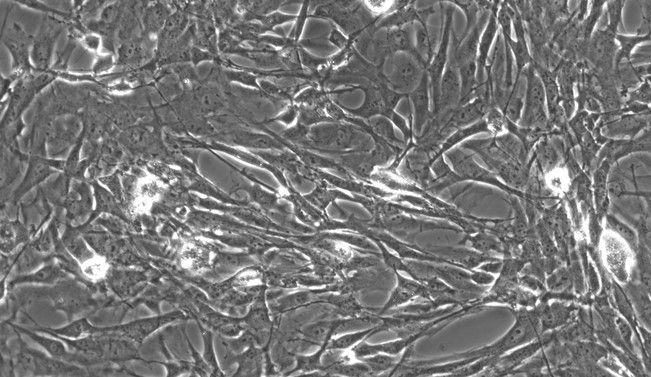 Primary Rat Choroid Plexus Fibroblasts (CPF)