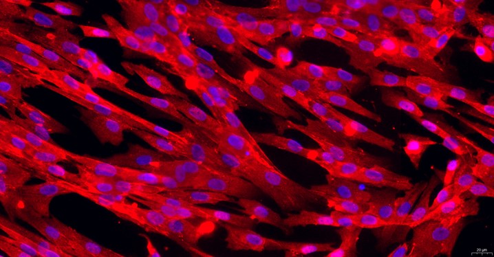 Primary Canine Conjunctival Fibroblasts (CJVF)