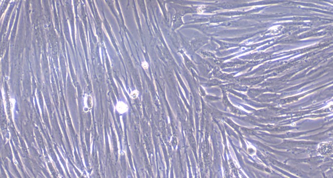 Primary Canine Conjunctival Fibroblasts (CJVF)