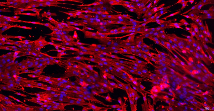 Primary Canine Conjunctival Fibroblasts (CJVF)