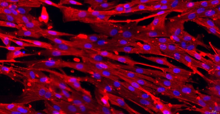 Primary Canine Conjunctival Fibroblasts (CJVF)