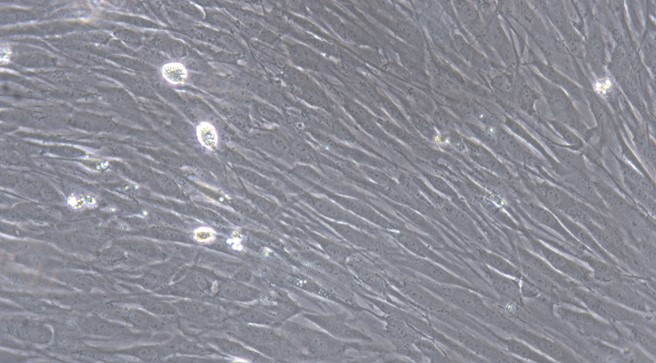 Primary Mouse Conjunctival Fibroblasts (CJVF)