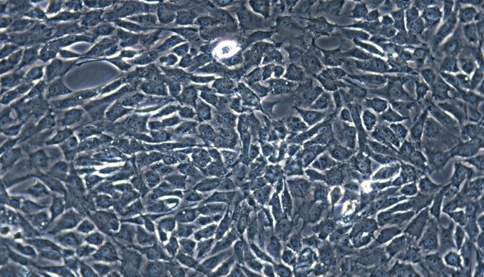 Primary Rat Conjunctival Fibroblasts (CJVF)