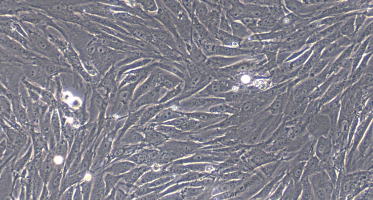 Primary Rabbit Conjunctival Fibroblasts (CJVF)