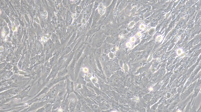 Primary Porcine Bladder Smooth Muscle Cells (BSMC)