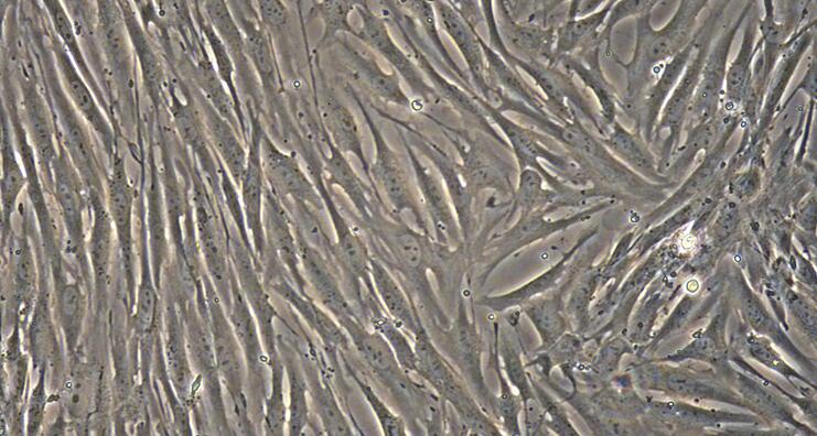 Primary Rabbit Bladder Smooth Muscle Cells (BSMC)