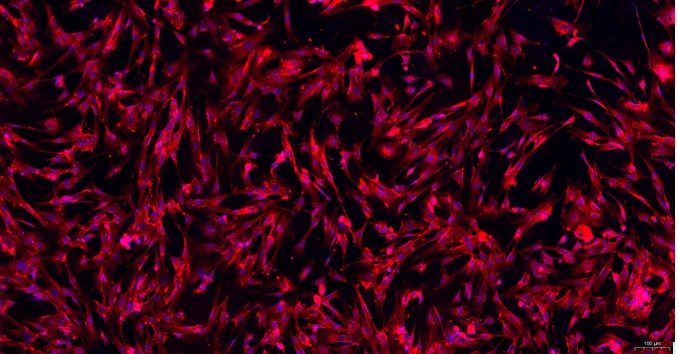 Primary Caprine Bladder Stromal Fibroblasts (BSF)