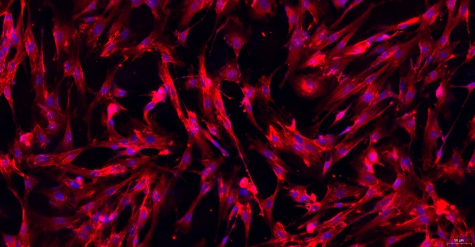 Primary Caprine Bladder Stromal Fibroblasts (BSF)